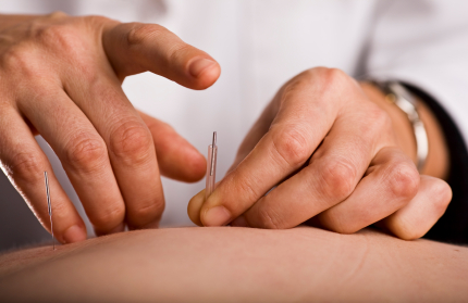 Pins & Needles: Acupuncture in Addiction Recovery.